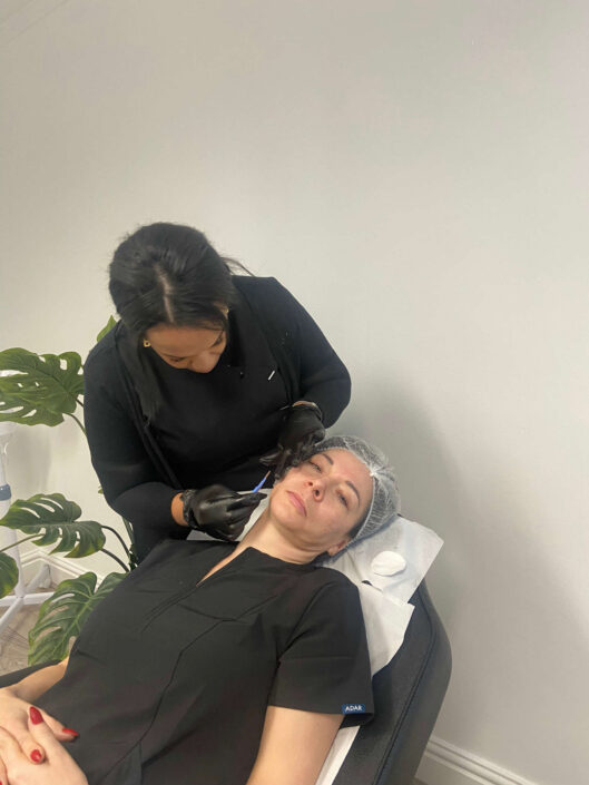 dermal-fillters-birmingham